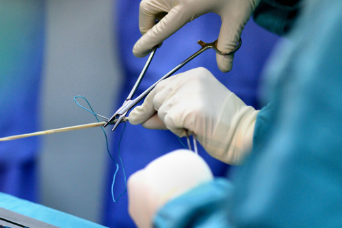 Phẫu thuật dây chằng chéo trước khi nào cần thiết là điều băn khoăn của nhiều bệnh nhân.