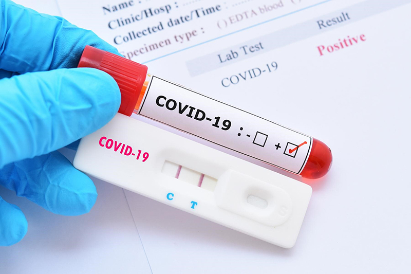 Danh sách các đơn vị đã được Bộ Y tế cho phép thực hiện xét nghiệm khẳng định COVID-19 (cập nhật đến ngày 22/02/2022)