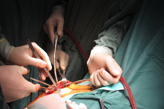 Chế độ chăm sóc và tập phục hồi chức năng sau "Phẫu thuật thay khớp gối" tại bệnh viện đa khoa Hòa Bình TP.Hải Dương